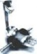 Foot Drop Boot IMI-29XX