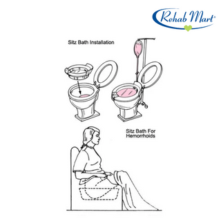 Sitz Bath Hip Bath - Image 3